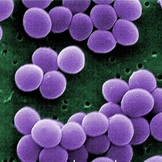 methicillin resistant staphylococcus aureus culture test